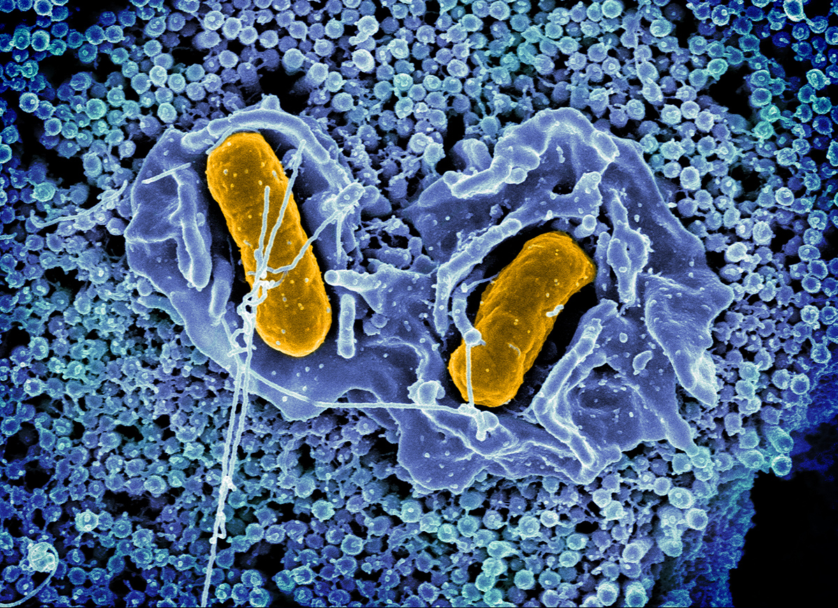 Scanning electron micrograph of Salmonella typhimurium invading a human epithelial cell.