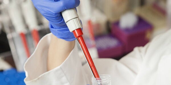 student pipetting